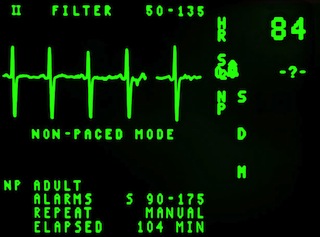 ecg